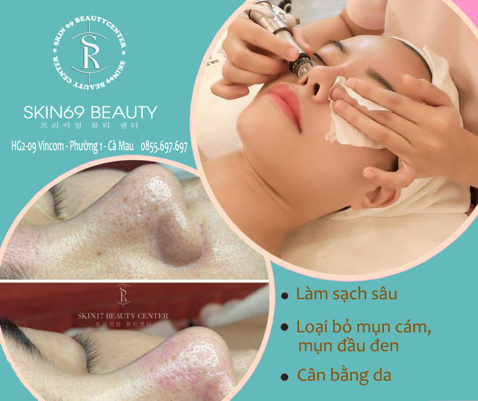 Có nên đi nặn mụn ở Spa không? Có nên nặn mụn ẩn ở Spa?