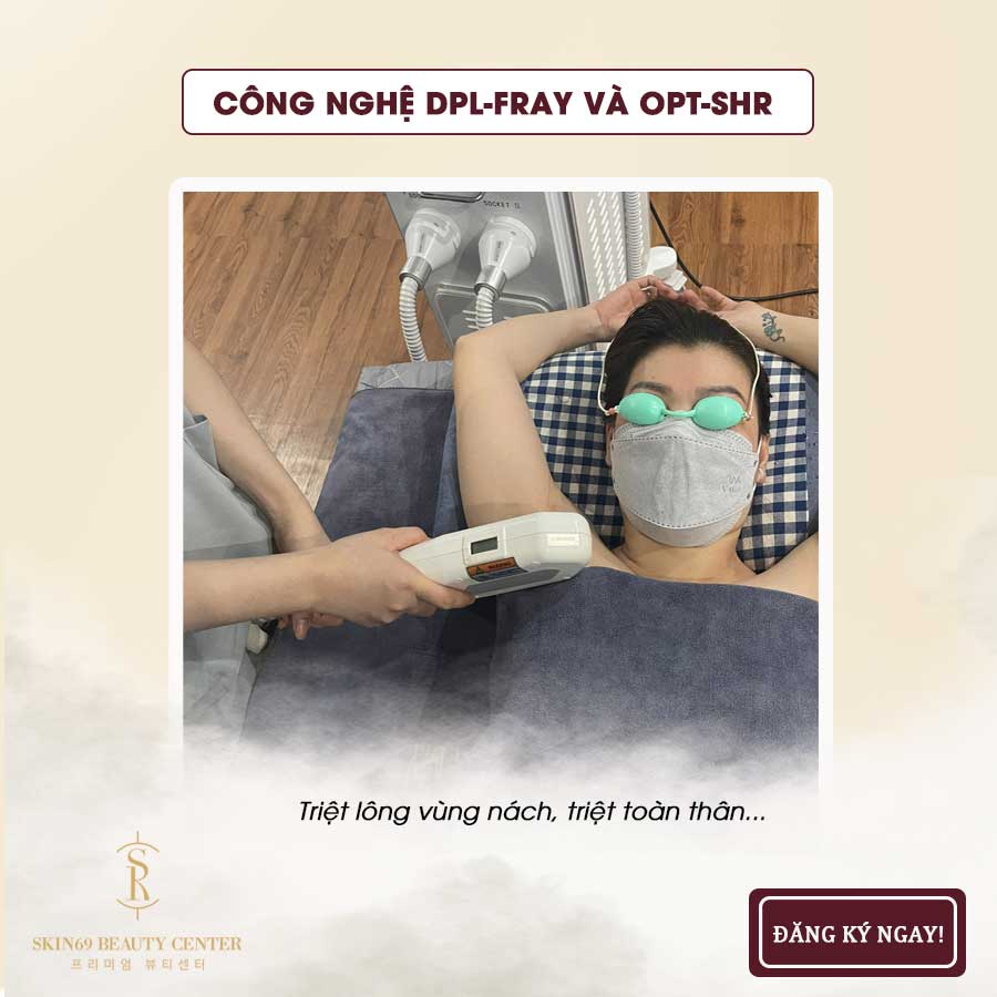 Công nghệ triệt lông OPT SHR kết hợp DPL Fray tại Skin69 Beauty Cà Mau