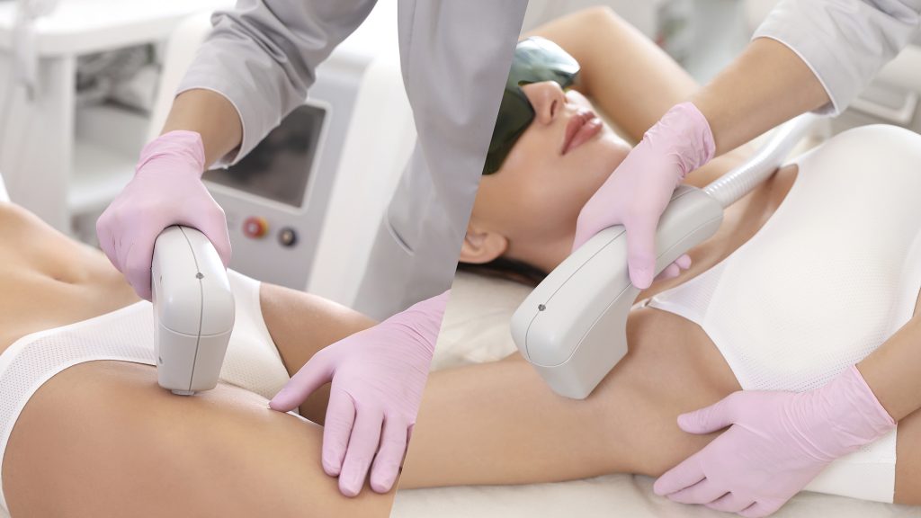 Công nghệ triệt lông Diode Laser tại PK Spa Cà Mau sẽ thế nào?