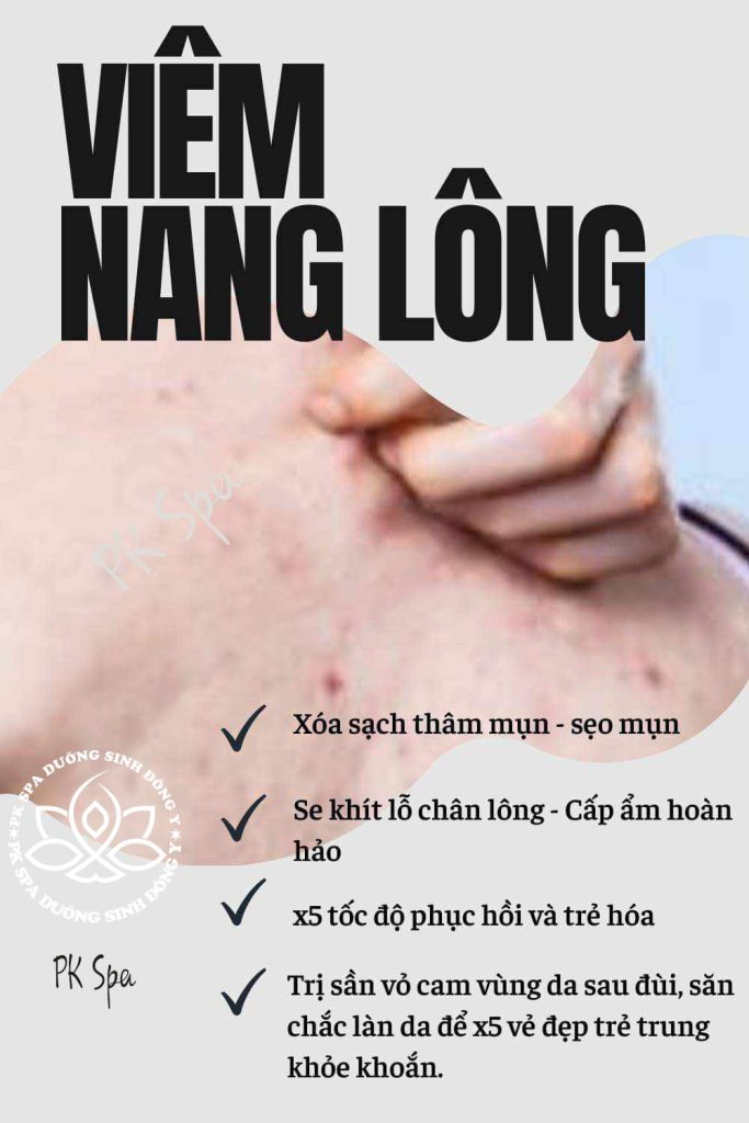 Thế nào là Viêm Nang Lông?