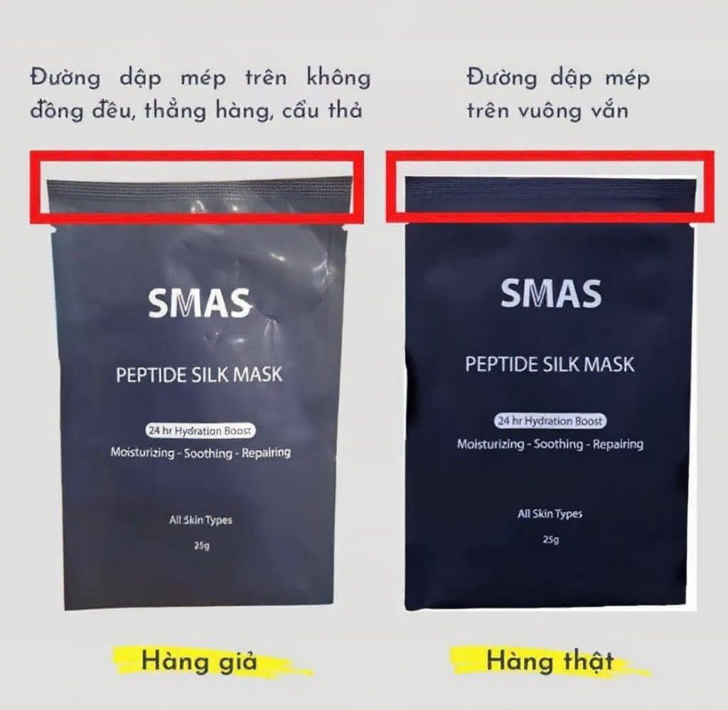 Phan biet mat na SMAS that va gia Phan biet mat na SMAS that va gia