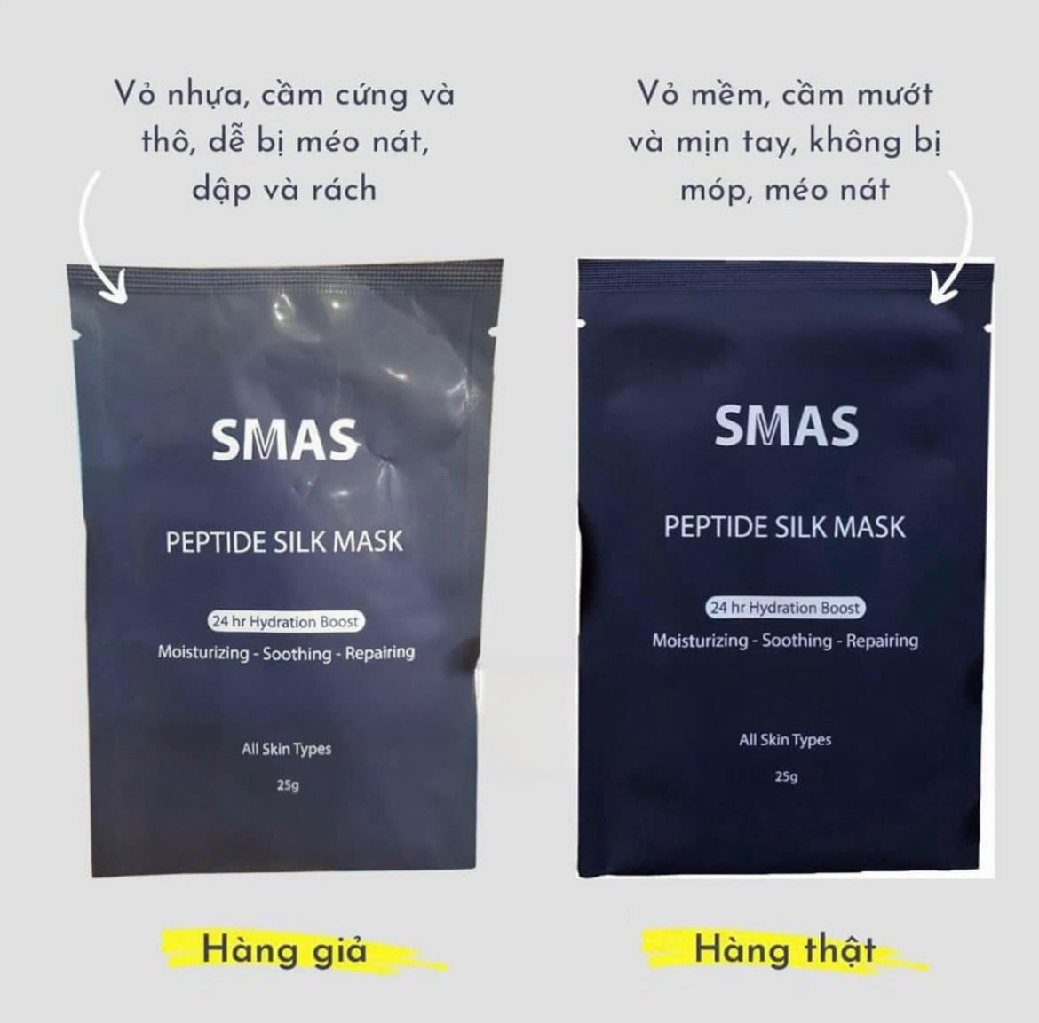 Phan biet mat na SMAS that va gia Phan biet mat na SMAS that va gia